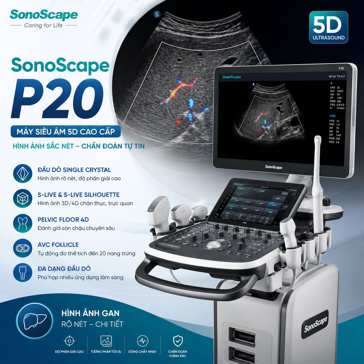 Tổng hợp các mẫu máy siêu âm 5D SonoScape đang được bán nhiều nhất tại Việt Nam
